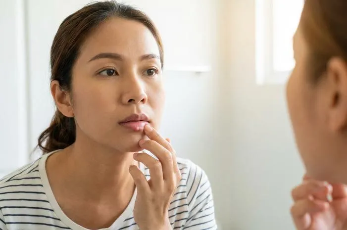Bibir Ada Benjolan? Jangan Panik, Ini Penjelasan Lengkapnya