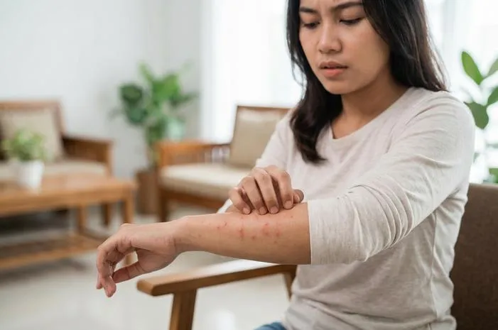 Penyebab Badan Bentol dan Gatal? Temukan Jawabannya Kini!