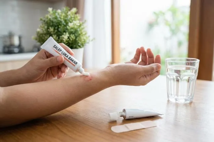 Salep Obat Luka Bakar: Pilih yang Pas, Cepat Sembuh Total!