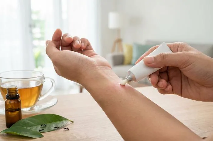 Semut Hitam Menyengat: Gejala dan Cara Mengatasinya Mudah