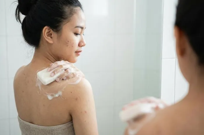 Sabun Hilangkan Jerawat Punggung: Auto Mulus!