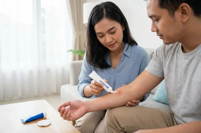 Manfaat Salep Benoson Redakan Gatal dan Ruam Kulit