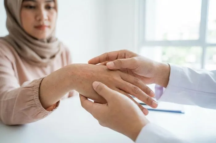Ruam di Tangan Gatal Tak Tertahankan? Ini Solusinya