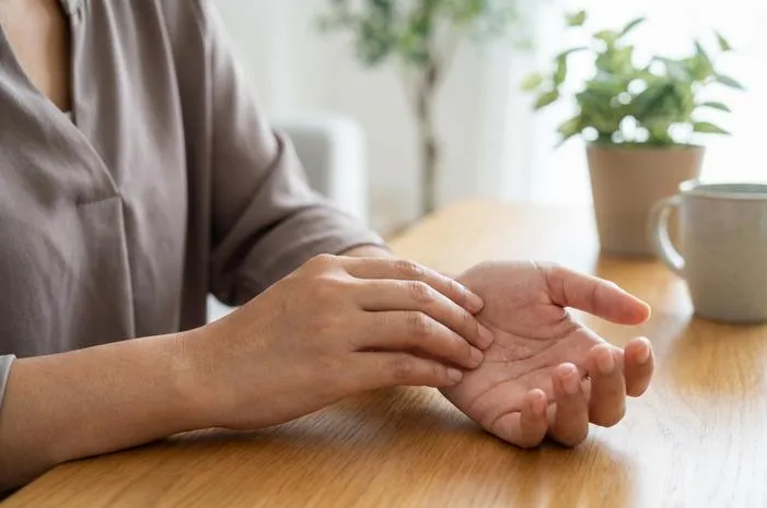 Kurap Tangan: Gejala, Penyebab, Cara Mengobati Tinea Manuum