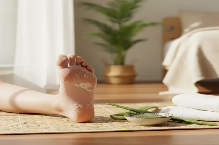 Kulit Mengelupas di Kaki: Solusi Mudah dan Cepat!