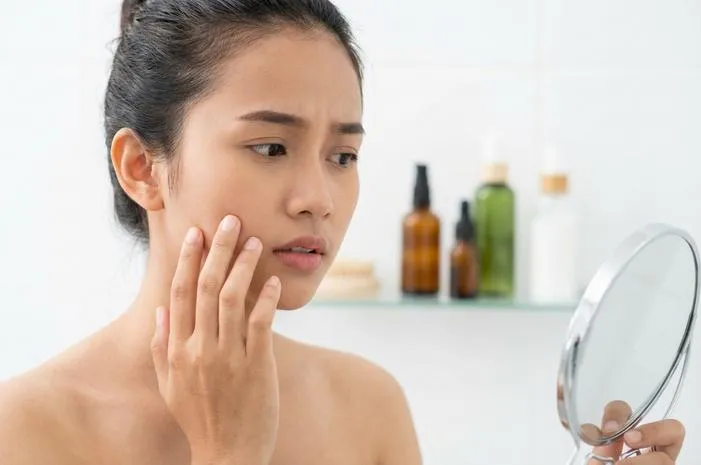 Masalah Kulit Wajah Beres! Wajah Glowing Penuh Percaya Diri