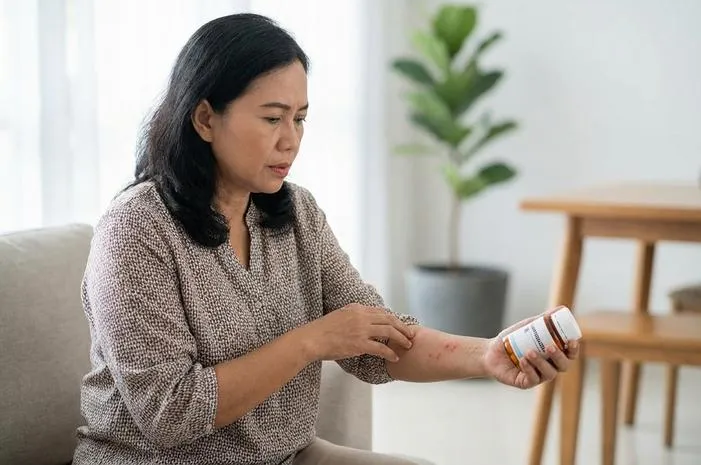 Yuk Kenali Alergi Sulfa: Gejala dan Solusi Amannya.