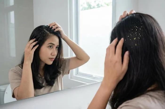 Perbedaan Ketombe Basah dan Kering, Mana Punyamu?