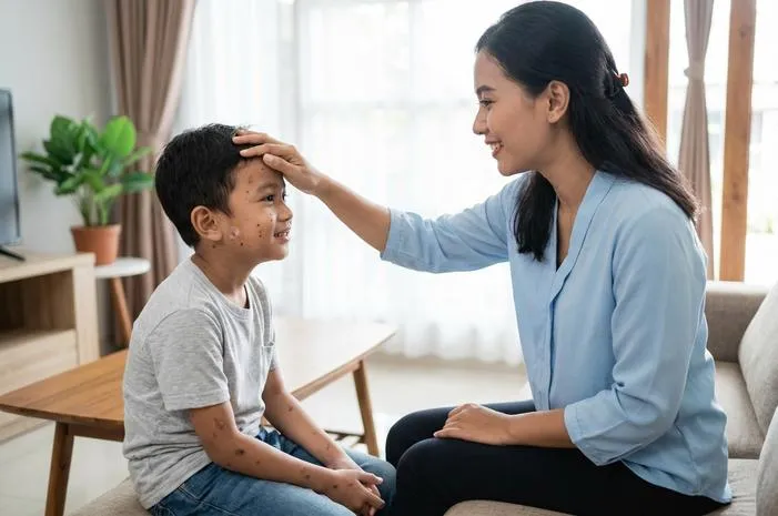 Berapa Hari Campak Sembuh? Ini Jawabannya!