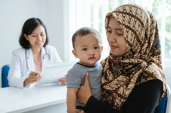 Yuk, Kenali Beragam Jenis Bibir Sumbing Lebih Dekat