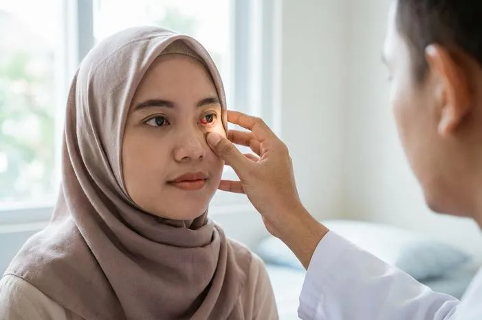 Subconjunctival Bleeding: Mata Merah, Tidak Bahaya Kok!