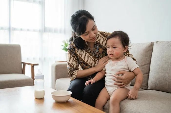 Ciri Anak Alergi Susu Formula Mudah Dikenali Kok