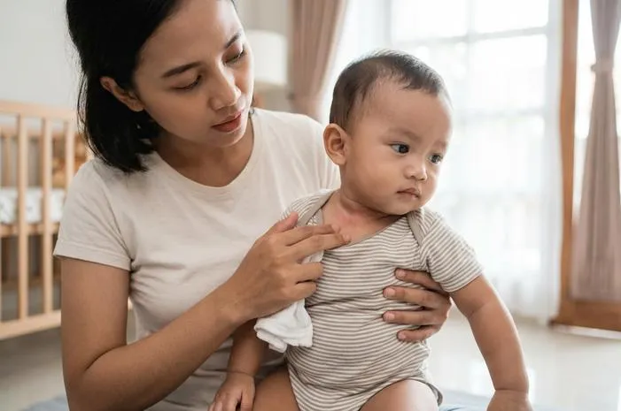 Jangan Panik! Leher Bayi Lecet Bisa Diatasi Lho