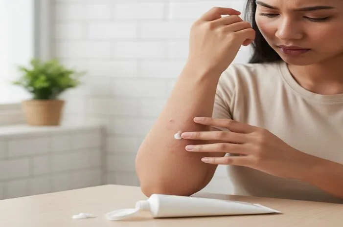 Alergi Handbody Bikin Gatal? Ini Cara Redakan Cepat