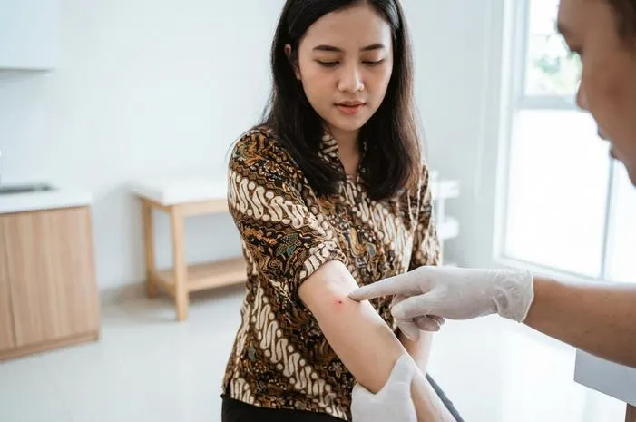 Bekas Sengatan Kalajengking: Perlu Panik atau Biasa Saja?