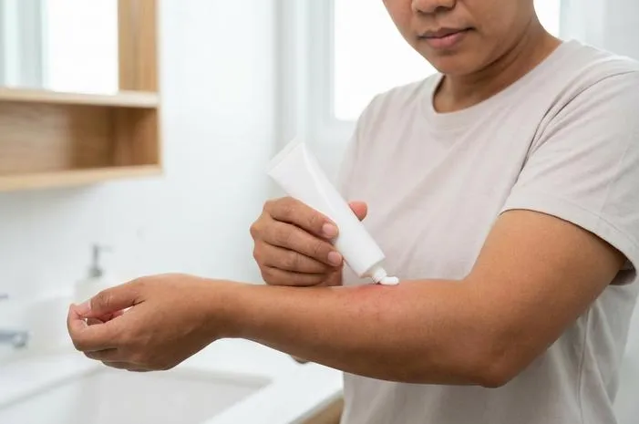 Rekomendasi Salep untuk Biang Keringat Dewasa, Reda Total