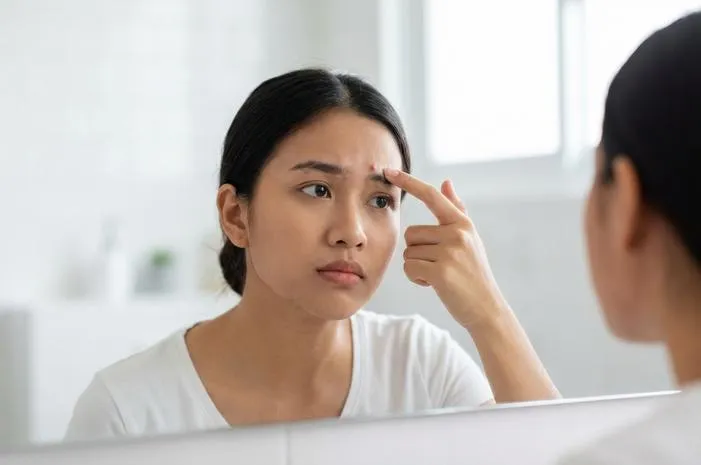 Bikin Penasaran! Kenapa Jerawat di Alis Sering Muncul?