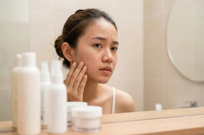 Kenali Ciri-Ciri Muka Alergi Kosmetik dengan Mudah