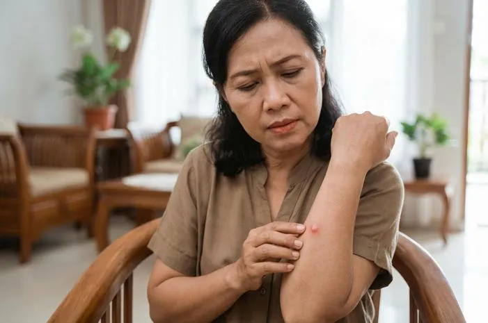 Bisul Seperti Apa? Cek Bentuk dan Cara Mengatasi