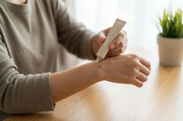 Luka Bekas Bisul Berlubang? Begini Cara Obatinya Mudah