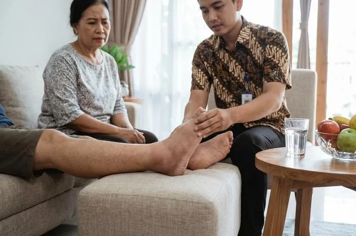 Kekurangan Albumin Kaki Bengkak? Ini Penyebabnya