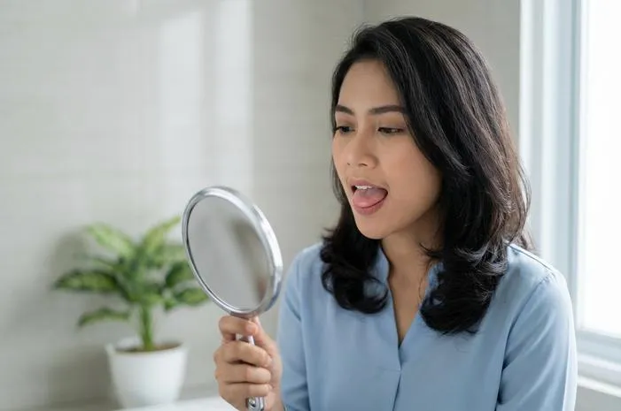 Lidah Ada Putih Putih? Pahami Penyebab dan Cara Atasinya