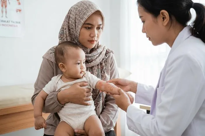 Kulit Bayi Melepuh Seperti Luka Bakar? Ini Solusinya!