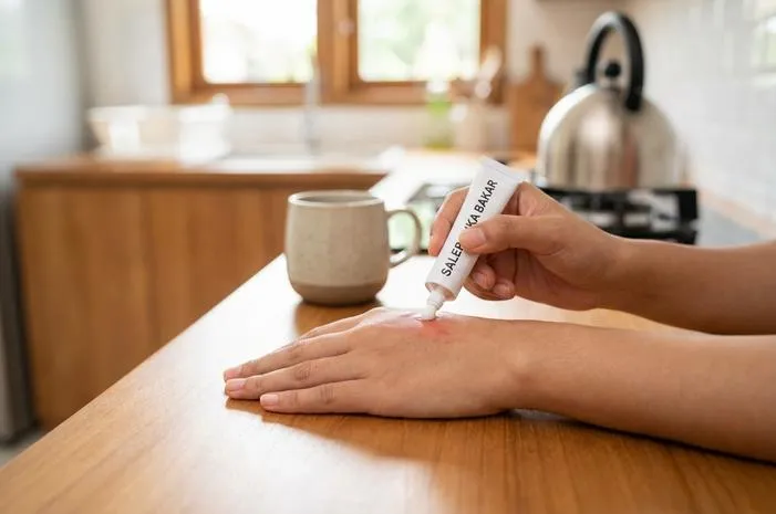 Salep Luka Kena Air Panas: Redakan Nyeri, Cepat Pulih