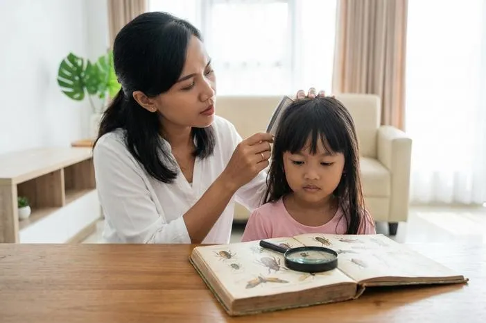 Fakta Unik Asal Usul Kutu Rambut, Bukan Jaminan Kotor