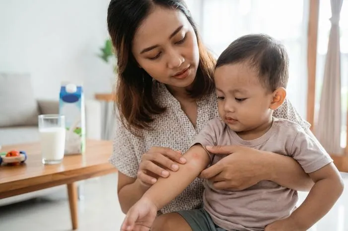 Ciri Ciri Alergi Susu Bayi, Moms Wajib Tahu!