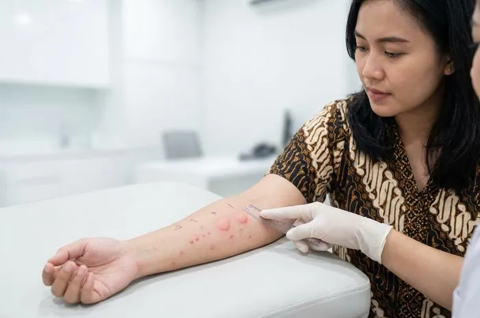 Skin Test Alergi Positif: Makna dan Langkah Tepat