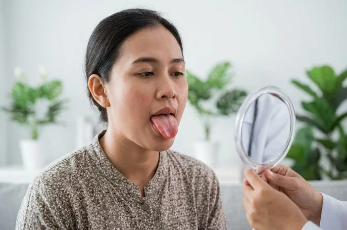 Atrofi Papil Lidah: Kenapa Lidah Jadi Halus Licin?