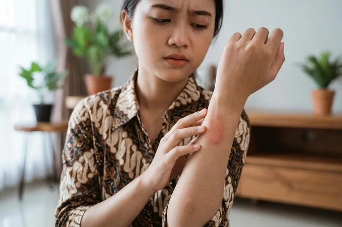 Kenali Ciri-ciri Kena Tomcat: Jangan Sampai Salah!