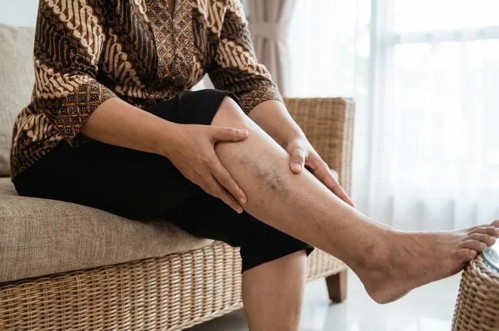 Cegah Kelainan Pembuluh Darah: Kenali Gejala dan Solusi