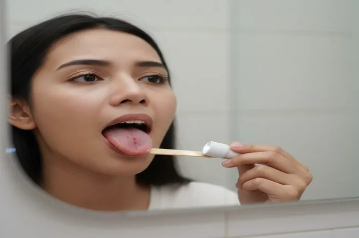 Bintik di Lidah Belakang: Normal atau Waspada?