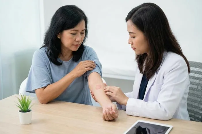 Nummular Eczema: Atasi Gatal dan Bercak Koin Secara Efektif