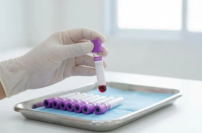 Tabung EDTA Ungu: Rahasia Sampel Darah Tetap Utuh