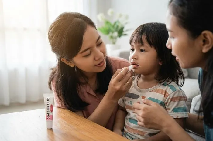 Bibir Pecah Berdarah Anak? Ini Obat Alami Paling Aman