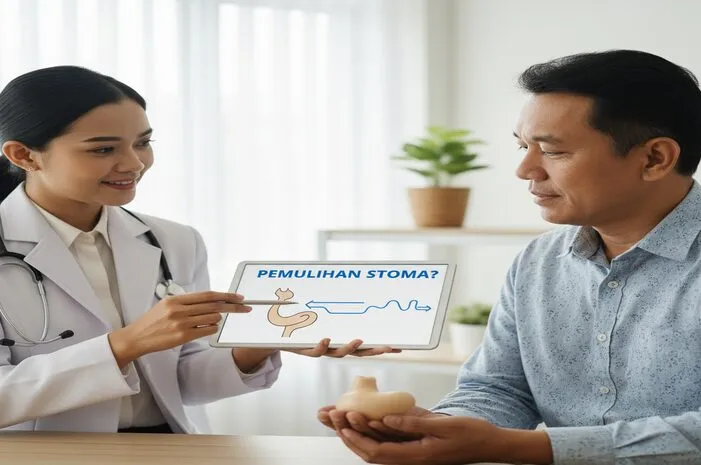Apakah Stoma Bisa Sembuh? Kupas Tuntas Prosesnya