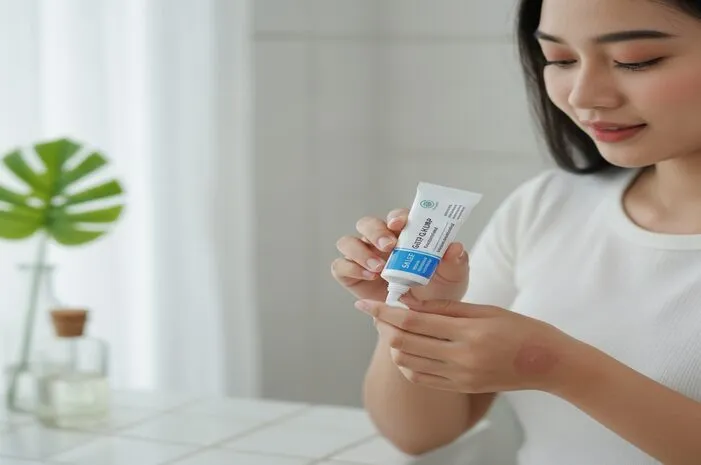 Salep Gatal Kurap Paling Ampuh Redakan Gatal Seketika