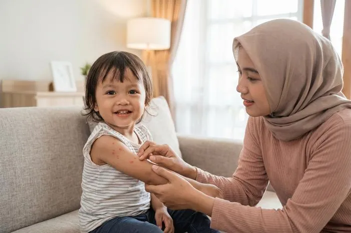 Mengapa Campak Tapi Tidak Demam? Simak Penjelasannya