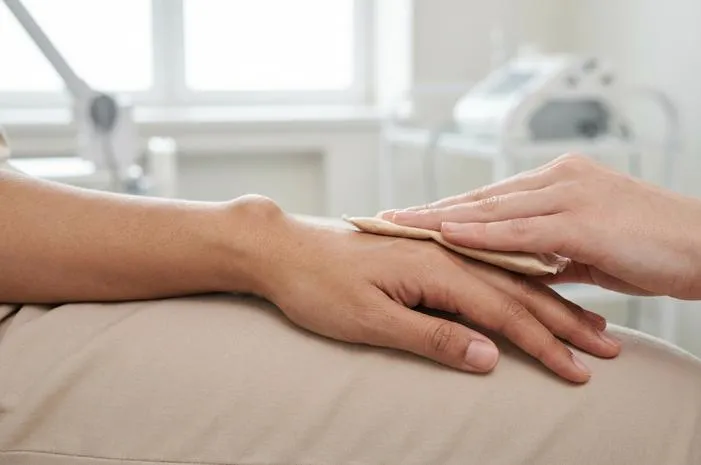 Cara Menghilangkan Kista Ganglion di Tangan Secara Tuntas