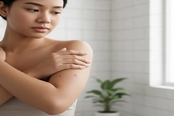 Jerawat di Siku? Ketahui Penyebab dan Cara Atasinya