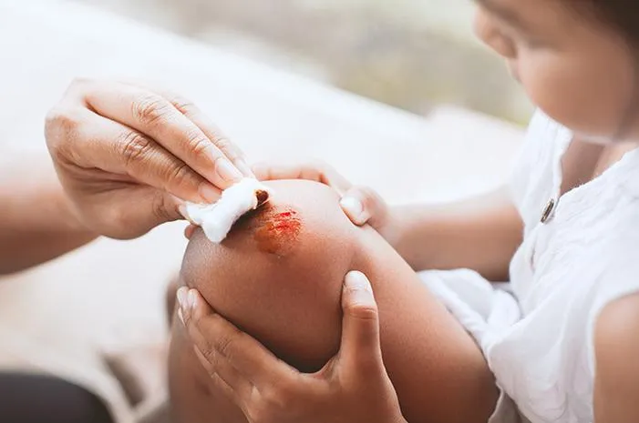 Membersihkan Luka dengan NaCl, Ini Cara Praktisnya