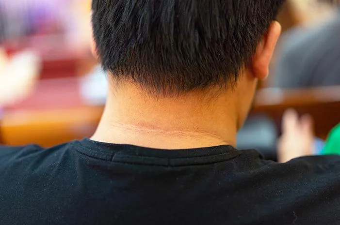 Pembersih Leher Hitam: Resep Alami dan Skincare Ampuh