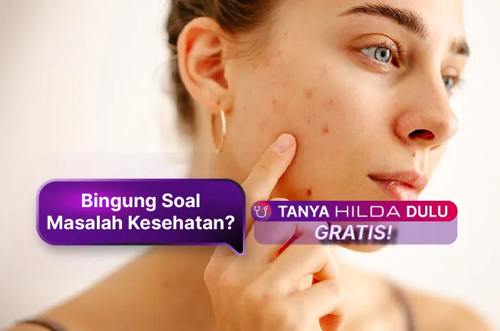 Penyebab Munculnya Jerawat Batu di Wajah