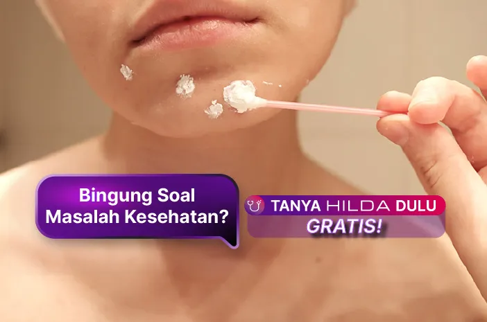 Pilihan Salep Jerawat Batu yang Efektif di Apotek