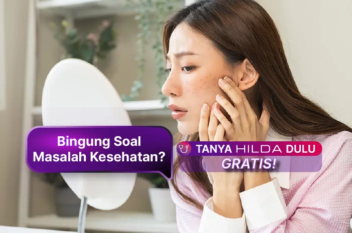 PIE: Cara Ampuh Hilangkan Bekas Jerawat Merah Membandel