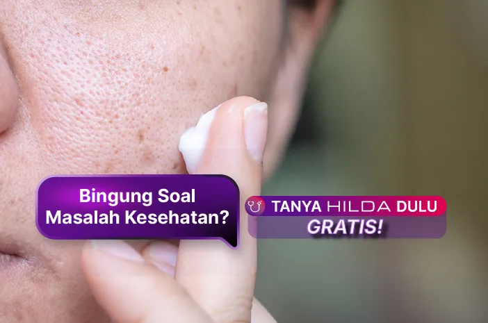 Obat Penghilang Flek Hitam di Wajah Paling Ampuh dan Cara Pencegahannya