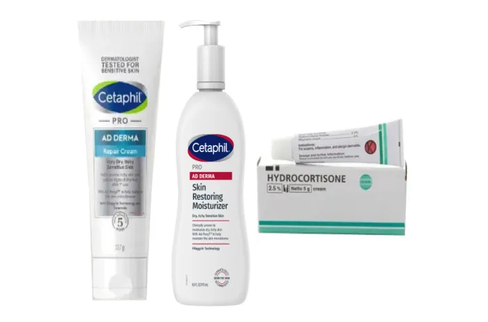 Inilah Obat untuk Mengatasi Eksim yang Kambuh